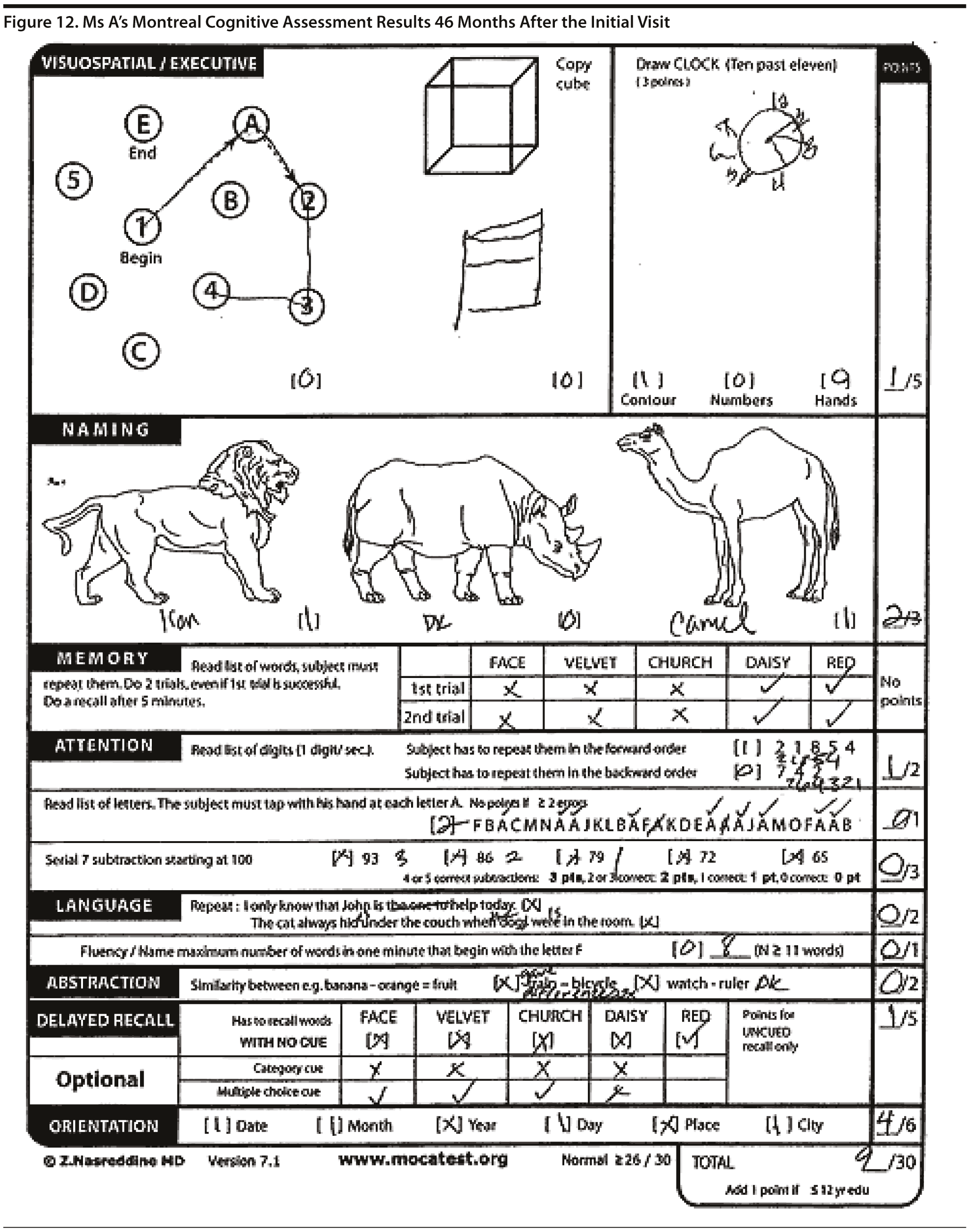 Figure 12