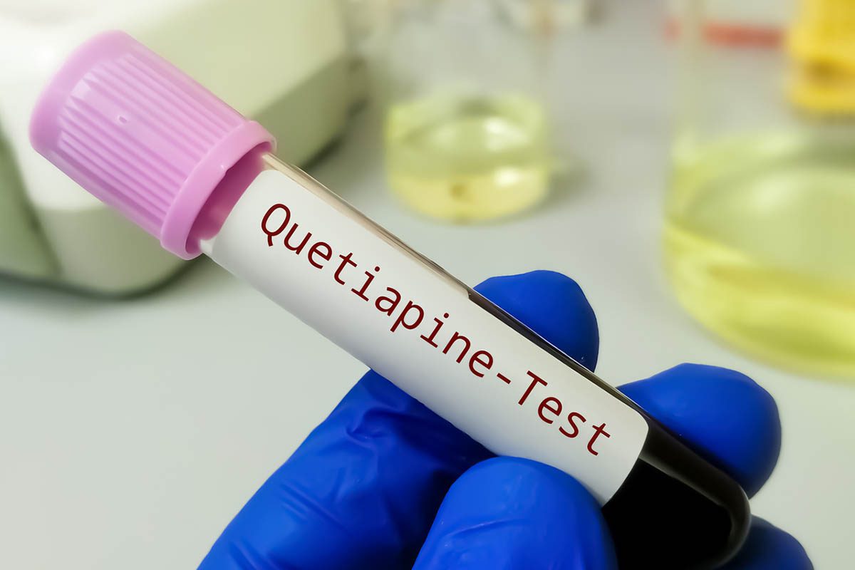 Quetiapine-Induced Neuroleptic Malignant Syndrome