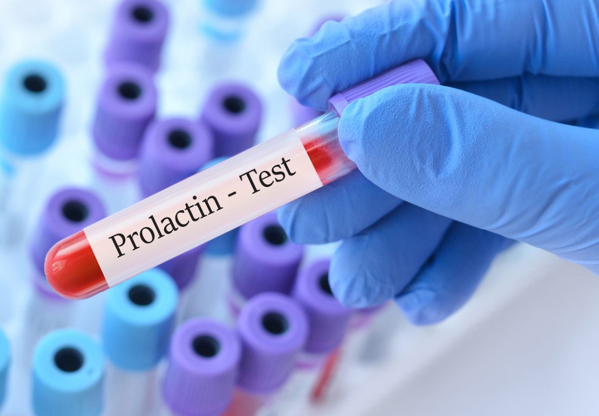 Unusually High Levels of Prolactin With Risperidone